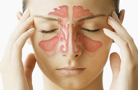 Sinusits_treatments