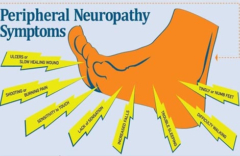 Peripheral Neuropathy Treatment DDK Hospital, Nagercoil